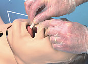 Break Away Teeth